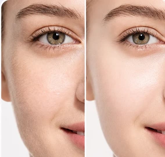 Antes y después: mejilla con vello fino y piel opaca, y la misma mejilla lisa y luminosa